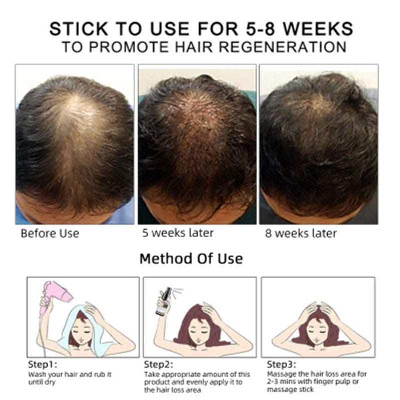 Hair Growth Oil for scalp care to prevent hair loss, 30ml bottle with packaging.