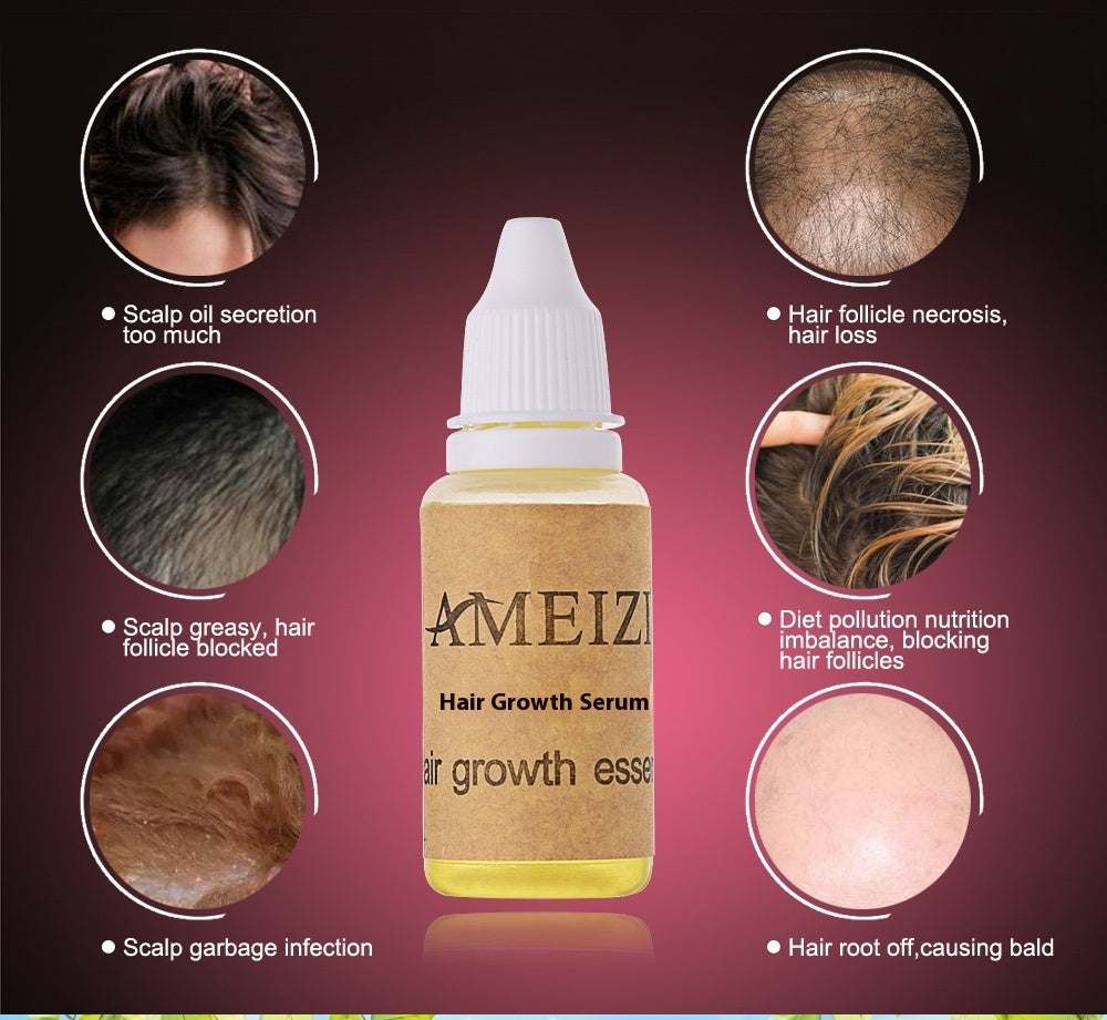 Hair Growth anti Hair Loss Liquid 20ml bottle with packaging.