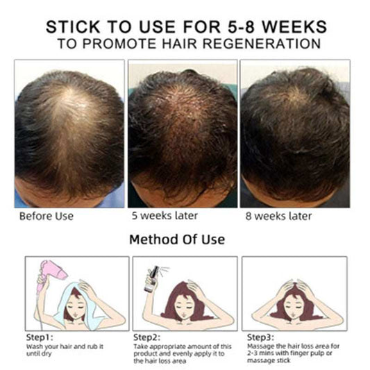 Hair Growth Oil for scalp care to prevent hair loss, 30ml bottle with packaging.