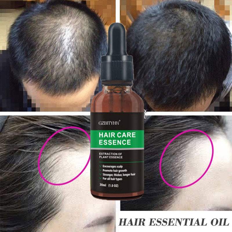 Hair Growth Oil for scalp care to prevent hair loss, 30ml bottle with packaging.