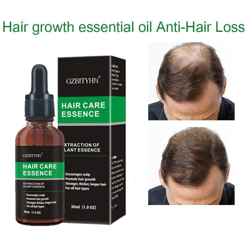 Hair Growth Oil for scalp care to prevent hair loss, 30ml bottle with packaging.