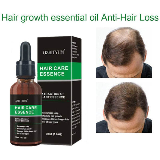 Hair Growth Oil for scalp care to prevent hair loss, 30ml bottle with packaging.